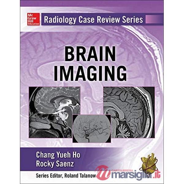 Radiology case review series: brain imaging