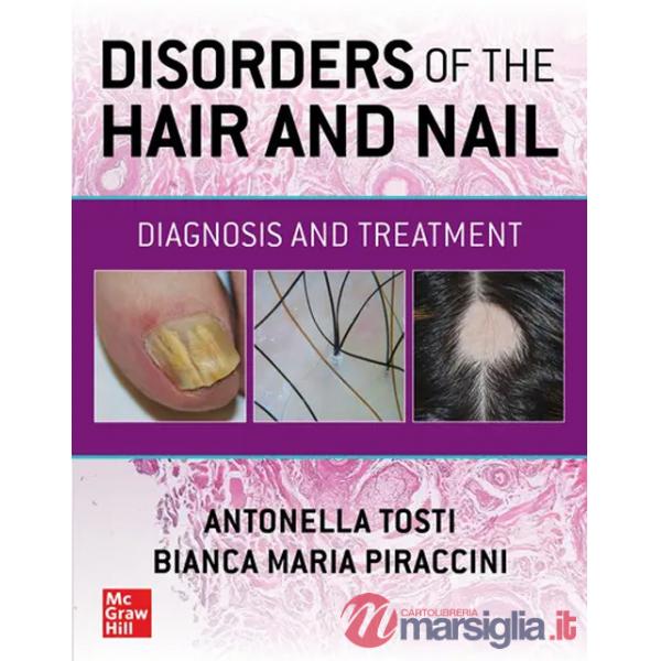 Disorders of the hair and nail: diagnosis and treatment