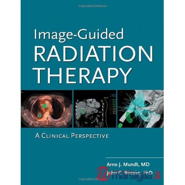 Image guided radiation therapy