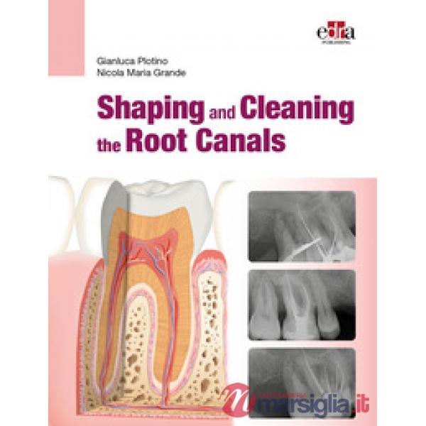 Shaping and Cleaning the Root Canals