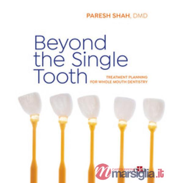 Beyond the Single Tooth. Treatment planning for whole mouth dentistry