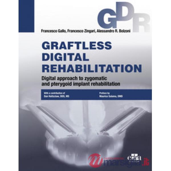 Graftless digital rehabilitation, gdr. Digital approach to zygomatic and pterygoid implant rehabilitation