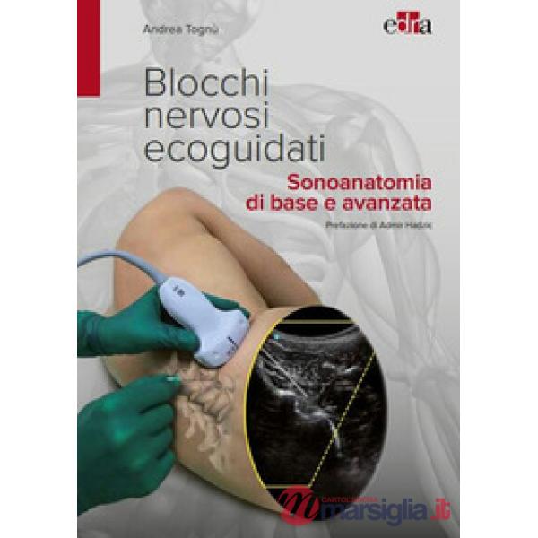 Blocchi nervosi ecoguidati. Sonoanatomia di base avanzata
