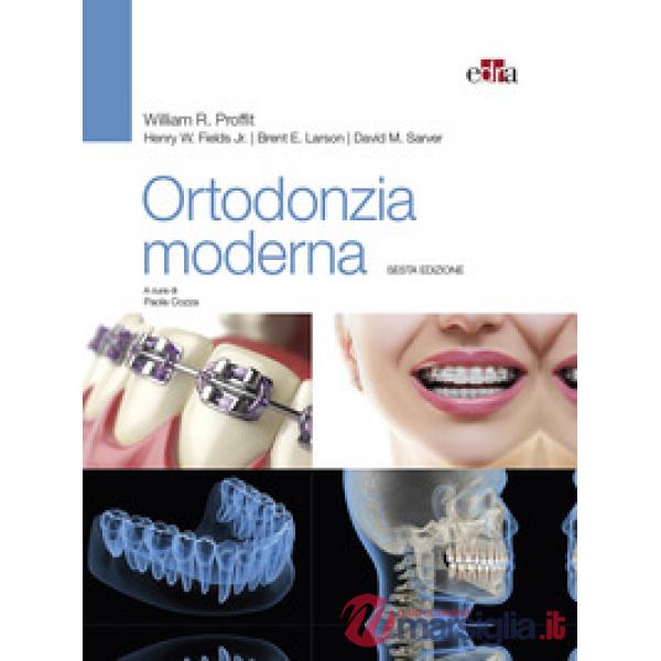 Ortodonzia moderna
