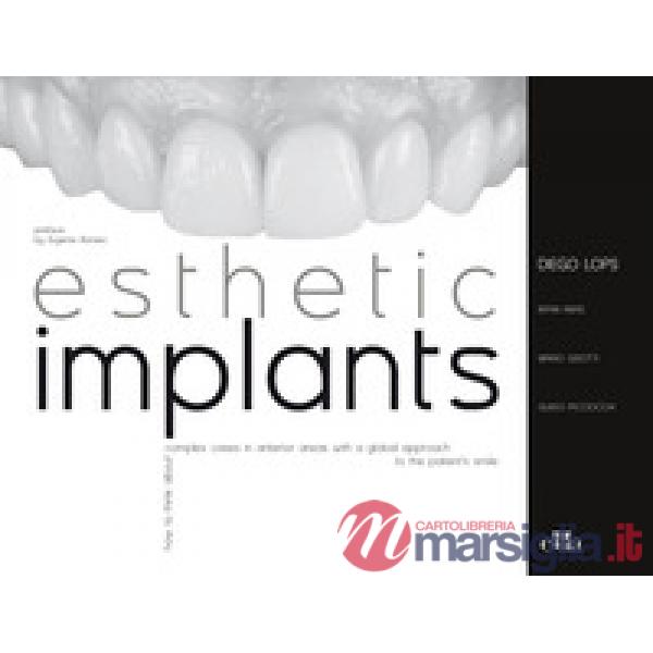 Esthetic implants. How to think about complex cases in anterior areas with a global approach to the patient' s smile