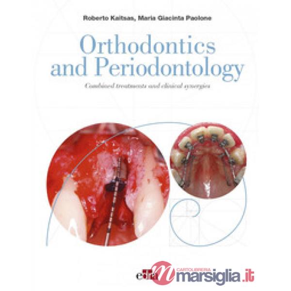 Orthodontics and Periodontology. Combined treatments and clinical synergies