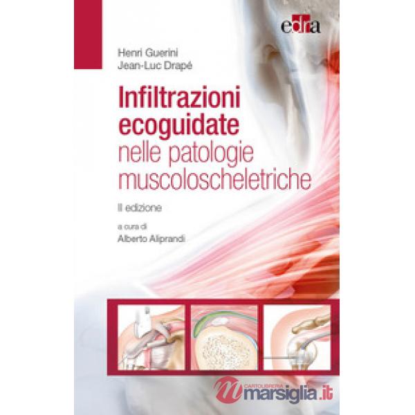 Infiltrazioni ecoguidate nelle patologie muscoloscheletriche