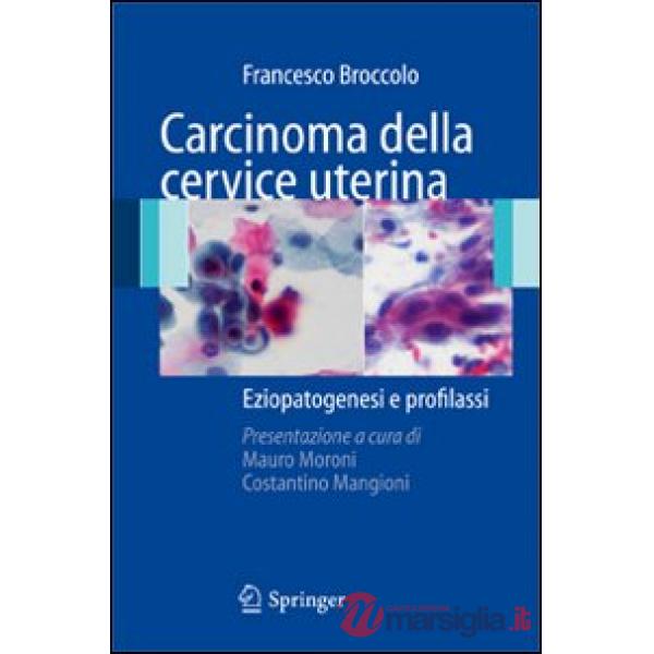 Carcinoma della cervice uterina. Eziopatogesi e profilassi