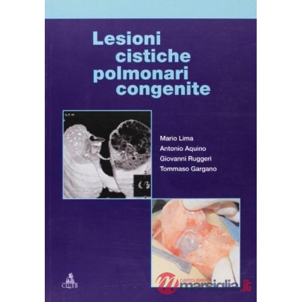 Lesioni cistiche polmonari congenite