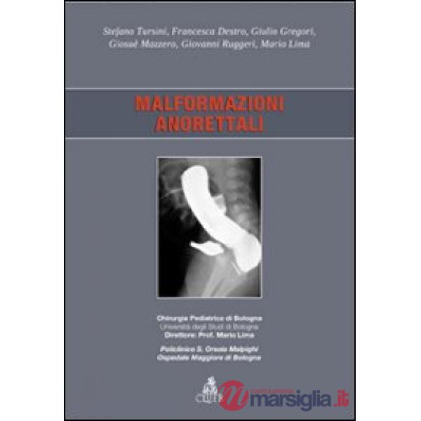 Malformazioni anorettali