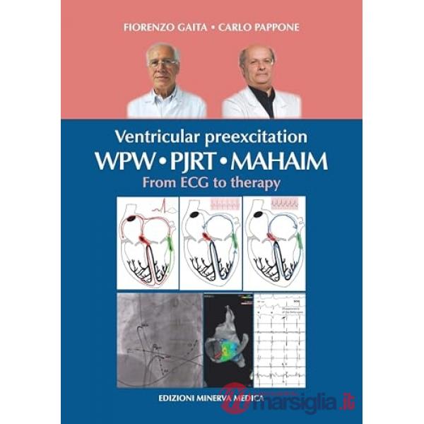 Ventricular preexcitation: WPW, PJRT, MAHAIM. From ECG to therapy