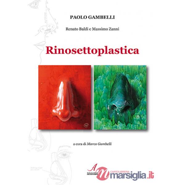 Rinosettoplastica
