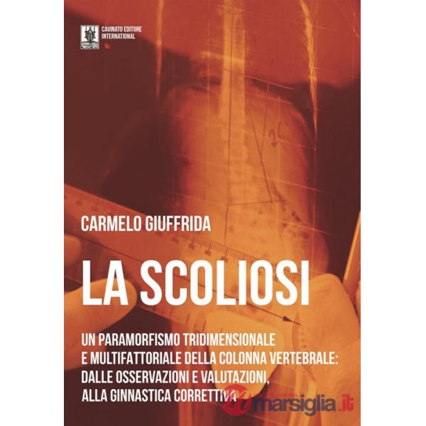 Scoliosi. Un paramorfismo tridimensionale e multifattoriale della colonna vertebrale: dalle osservazioni e valutazioni alla ginn