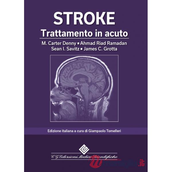 Stroke. Trattamento in acuto