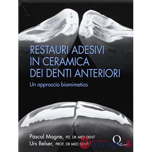Restauri adesivi in ceramica dei denti anteriori. Un approccio biomimetico