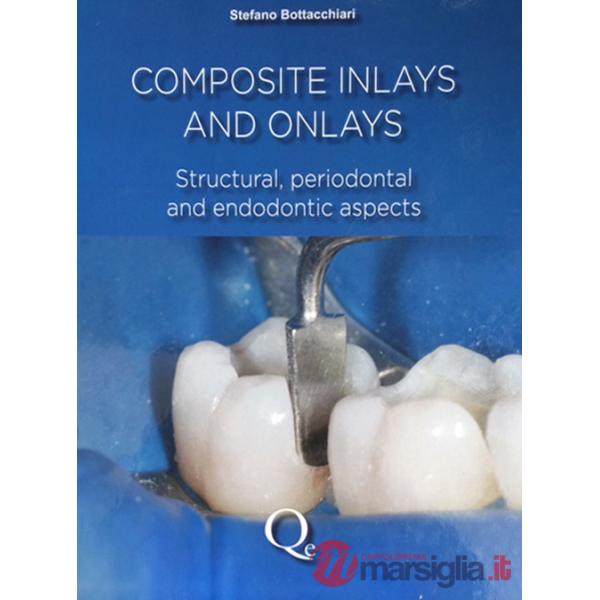 Composite inlays and onlays