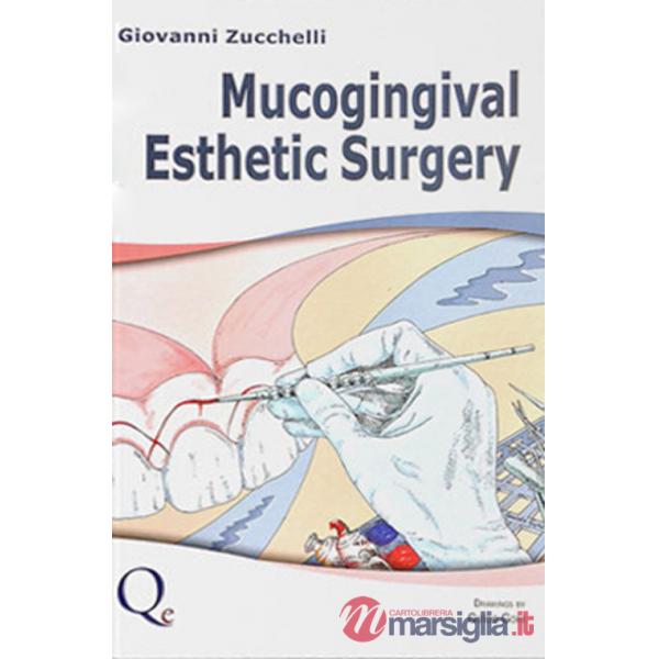 Mucogingival esthetic surgery