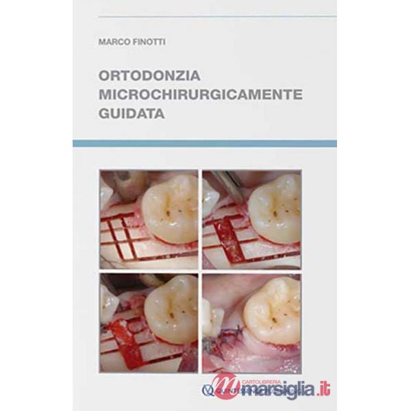 Ortodonzia microchirurgicamente guidata