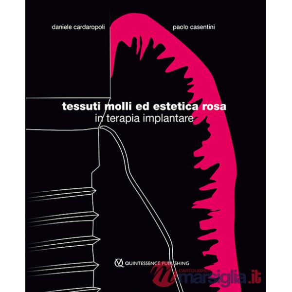 Tessuti molli ed estetica rosa in terapia implantare