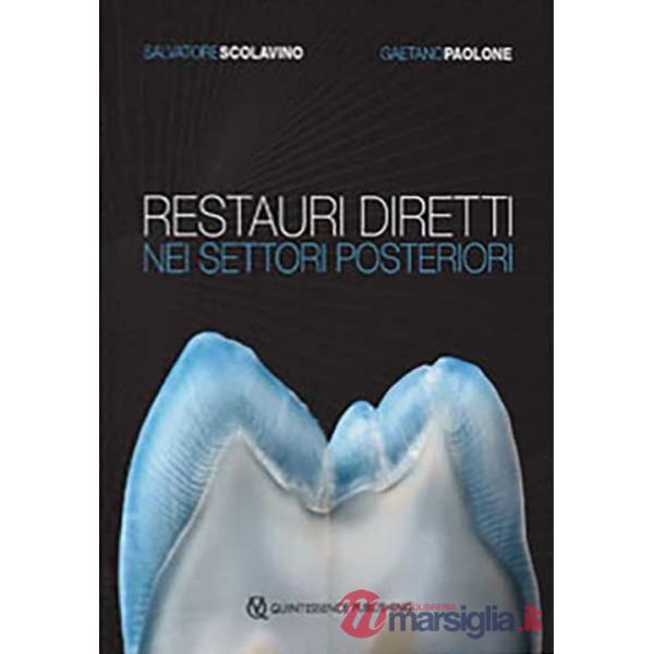 Restauri diretti nei settori posteriori