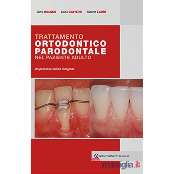 Trattamento ortodontico parodontale nel paziente adulto. Un percorso clinico integrato