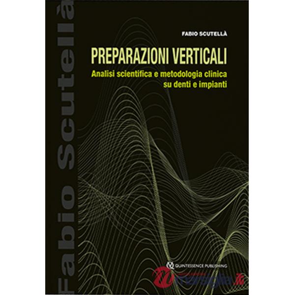 Preparazioni verticali. Analisi scientifica e metodologia clinica su denti e impianti