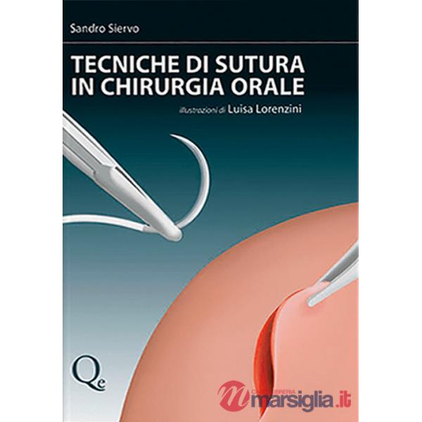 Tecniche di sutura in chirurgia orale
