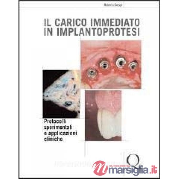 Carico immediato in implantoprotesi (Il)