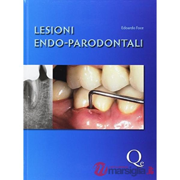 Lesioni endo-parodontali
