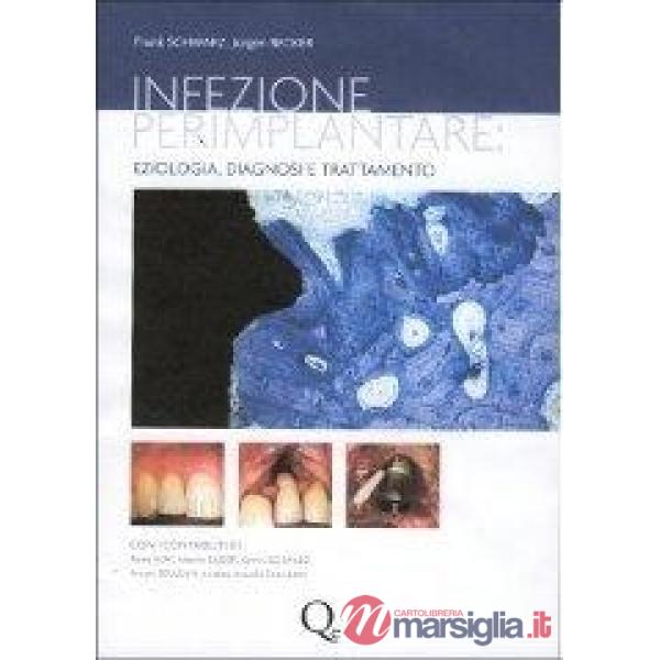 Infezione perimplantare: eziologia, diagnosi e trattamento