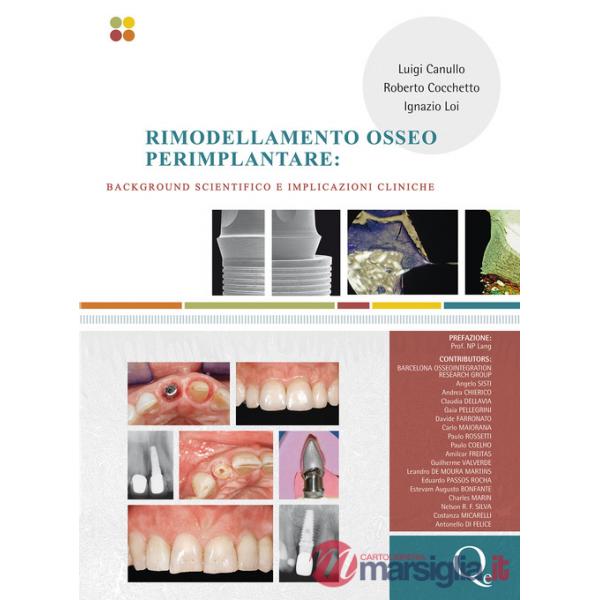 Rimodellamento osseo perimplantare. Background scientifico e implicazioni cliniche