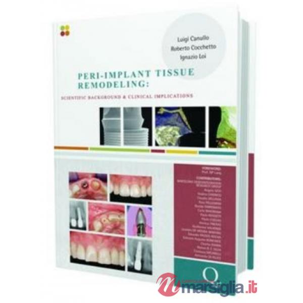 Peri-implant tissue remodeling. Scientific background and clinical implications