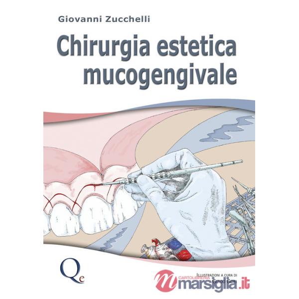 Chirurgia estetica mucogengivale