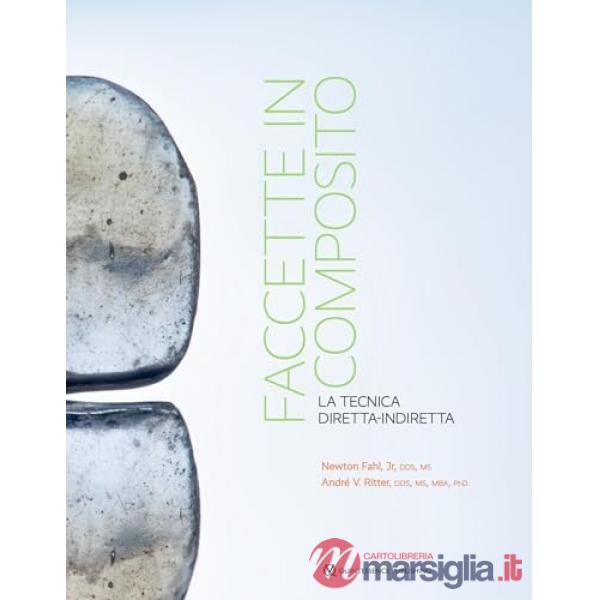 Faccette in composito. La tecnica diretta-indiretta