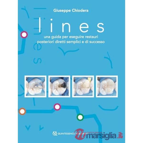 Lines. Una guida per eseguire restauri posteriori diretti semplici e di successo