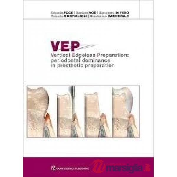 VEP. Vertical Edgeless Preparation: periodontal dominance in prosthetic preparation