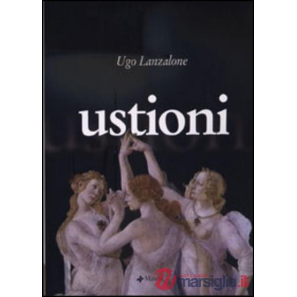 Ustioni