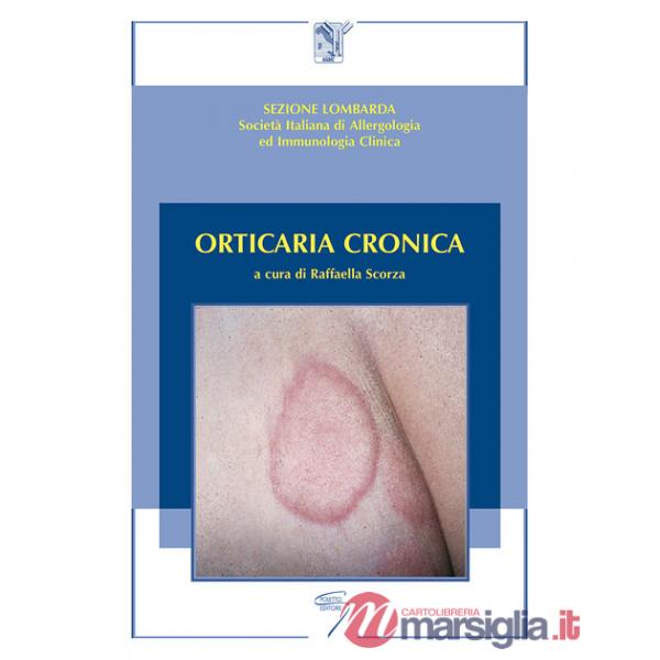 Orticaria cronica