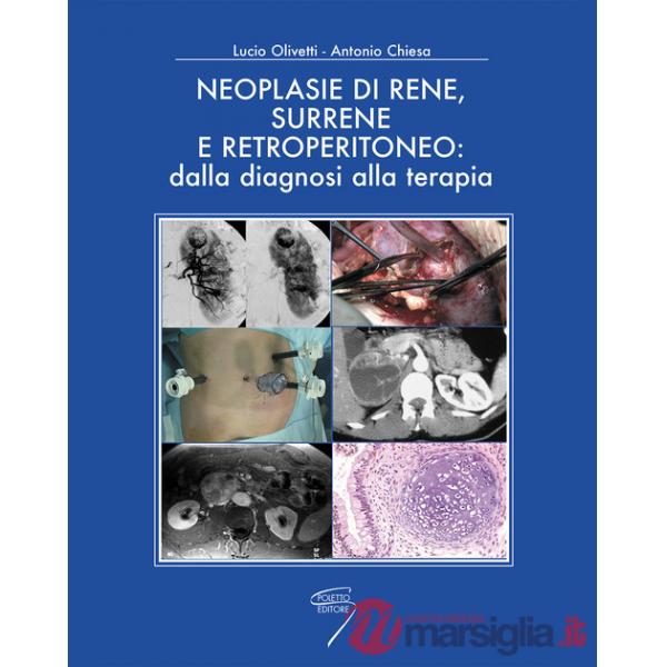 Neoplasie di rene, surrene e retroperitioneo: dalla diagnosi alla terapia
