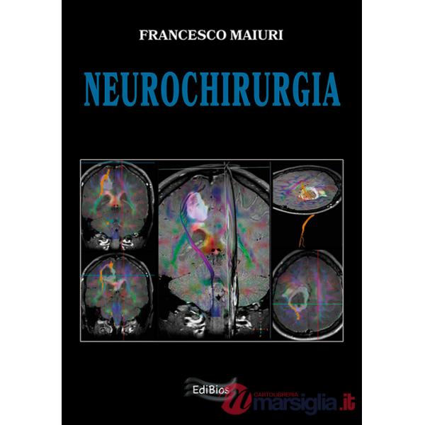 Neurochirurgia