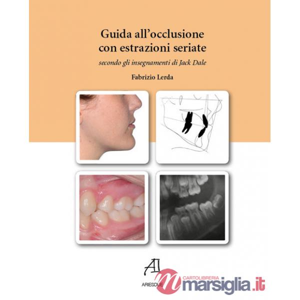 Guida all'occlusione con estrazioni seriate secondo gli insegnamenti di Jack Dale