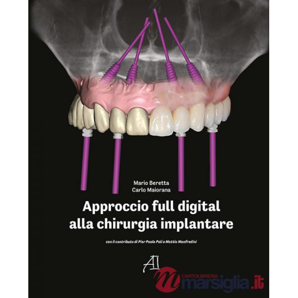 Approccio full digital alla chirurgia implantare