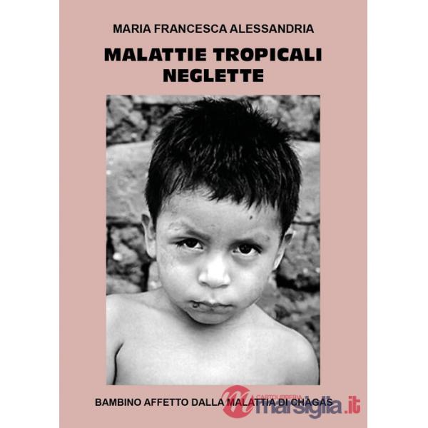 Malattie tropicali neglette