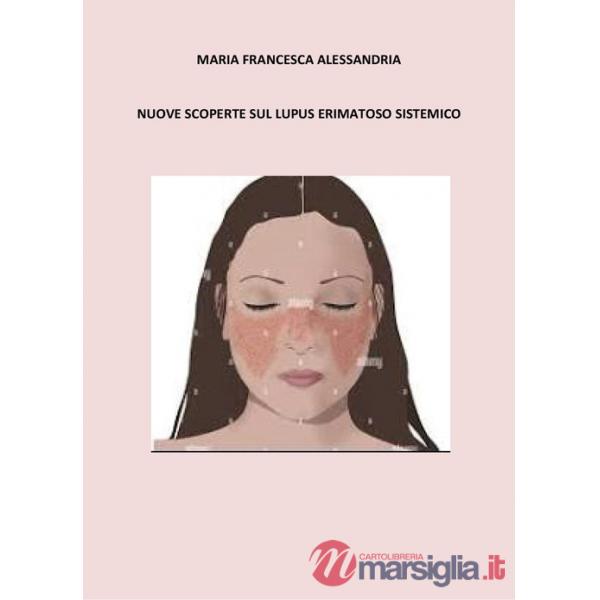 Nuove scoperte sul lupus erimatoso sistemico