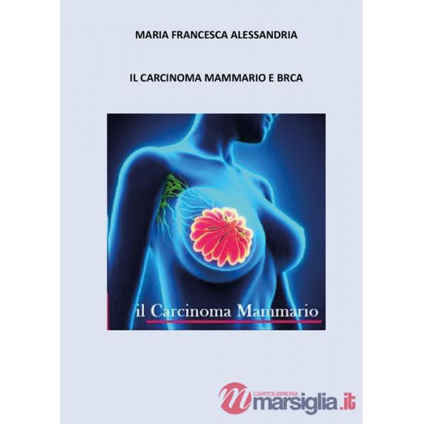 Carcinoma mammario e BRCA (Il)