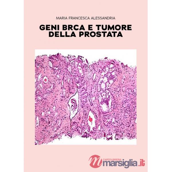 Geni BRCA e tumore della prostata