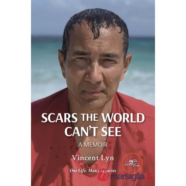 Scars the world can't see. A memoir
